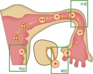 수정란 모습